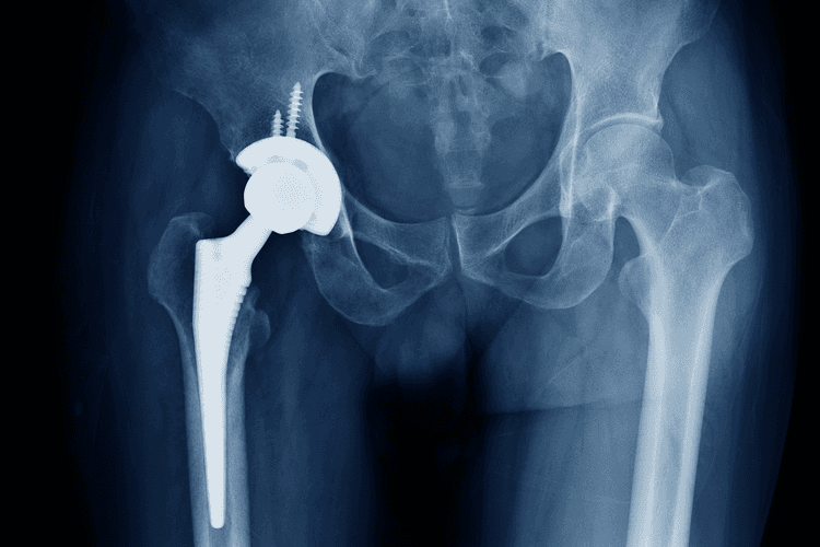 Contract Medical Manufacturer to Begin Operations Later this Year