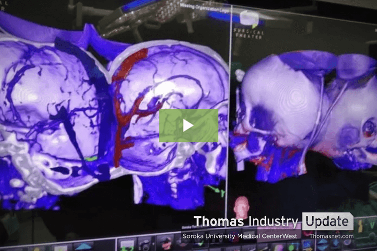 3D Printing, Virtual Reality Help Separate Twins Conjoined at the Head