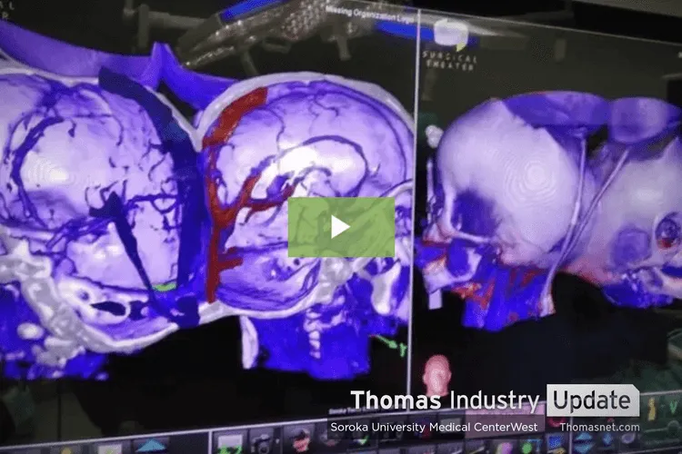 3D Printing, Virtual Reality Help Separate Twins Conjoined at the Head