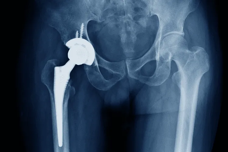 Contract Medical Manufacturer to Begin Operations Later this Year